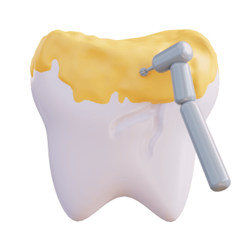 3d illustration of cleaning tooth decay with a drill png
