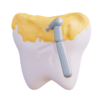 3d illustration of cleaning tooth decay with a drill png