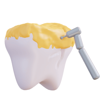 3d illustration of cleaning tooth decay with a drill png