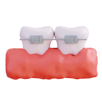 3d illustration of wearing braces png