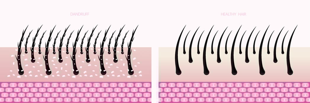 Hair protect and care technology concept illustration. vector