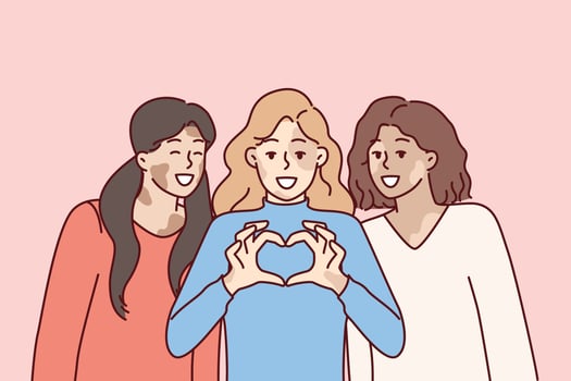 Three women with vitiligo syndrome are smiling demonstrating heart gesture as sign of self-love. Girl friends congratulate on vitiligo day calling for tolerance to people with depifmentation of skin vector