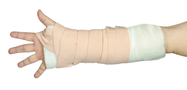 Hand making physical therapy to broken wrist from accident isolated png