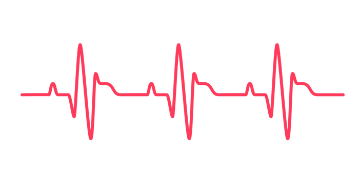 heart rhythm graph Checking your heartbeat for diagnosis png