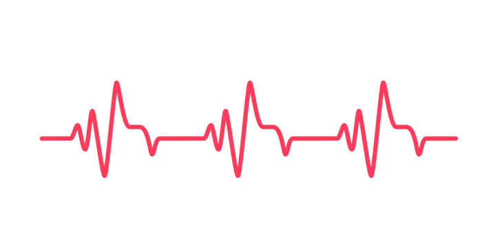 heart rhythm graph Checking your heartbeat for diagnosis png