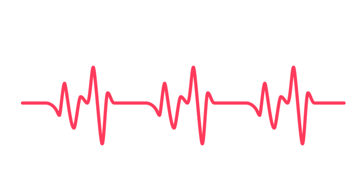 heart rhythm graph Checking your heartbeat for diagnosis png
