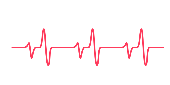 heart rhythm graph Checking your heartbeat for diagnosis png