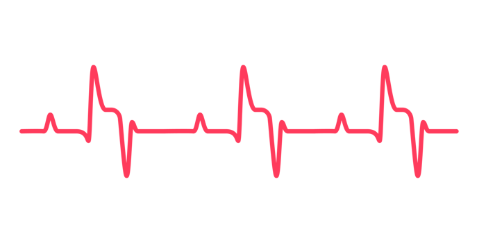 heart rhythm graph Checking your heartbeat for diagnosis png