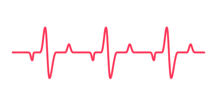 heart rhythm graph Checking your heartbeat for diagnosis png