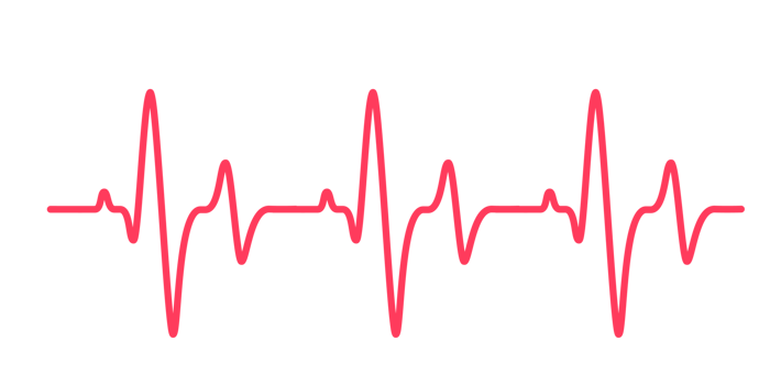 heart rhythm graph Checking your heartbeat for diagnosis png