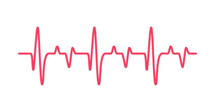heart rhythm graph Checking your heartbeat for diagnosis png