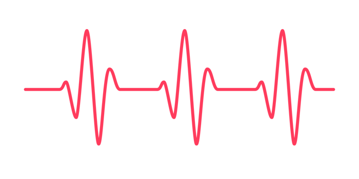 heart rhythm graph Checking your heartbeat for diagnosis png