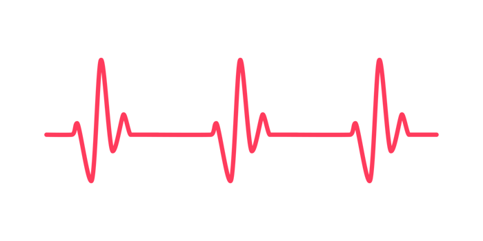 heart rhythm graph Checking your heartbeat for diagnosis png