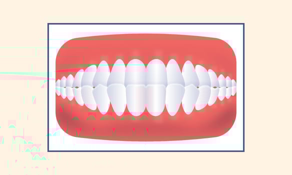 Underbite Teeth Jaw Icon Over Yellow Background. vector