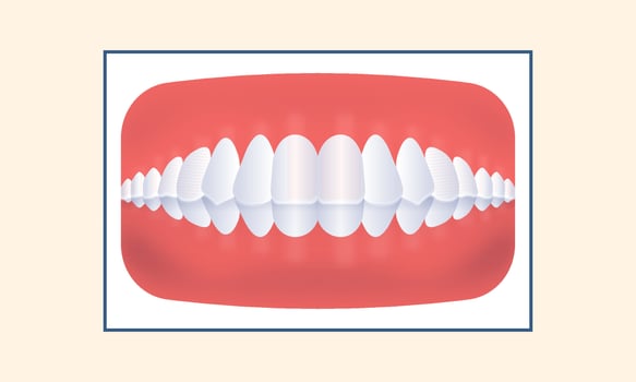 Deep Bite Human Teeth Icon Over Yellow Background. vector