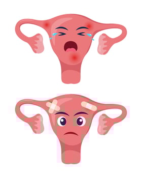 Sick uterus with pain ache or disease. Sad cartoon character uterus, body organ injured or unhealthy. Human cartoon anatomy, kids medicine. Vector illustration.