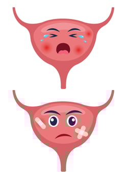 Sick bladder with pain ache or disease. Sad cartoon character bladder, body organ injured or unhealthy. Human cartoon anatomy, kids medicine. Vector illustration.