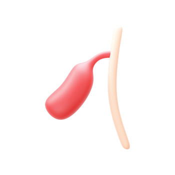 3D Render Of Gallbladder Polyps Element In Red Color. png