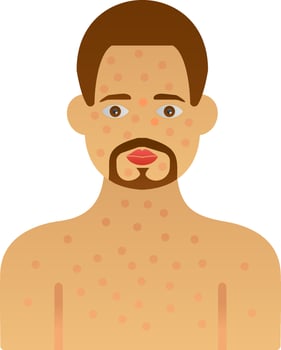 Anaphylaxis Vector Icon Design
