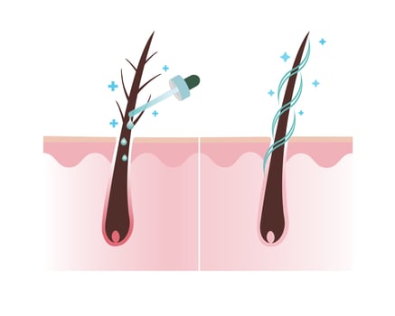 Treat damage hair with treatment and healthy hair scalp layer vector on white background. Hair care concept illustration.