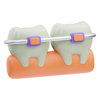 Braces dental 3D Illustration png