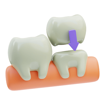 Dental Crown 3D Illustration png