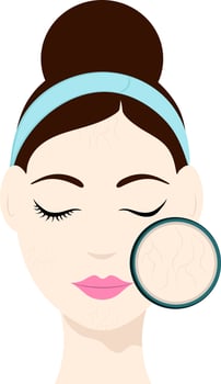 Flat Illustration Of Beautiful Girl With Dry Skin Face Icon. vector