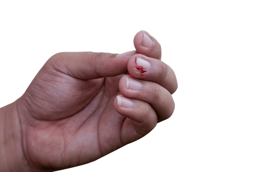 selective focus on bleeding fingers due to ingrown nails. in Indonesian it is called cantengan. paronychia disease. png