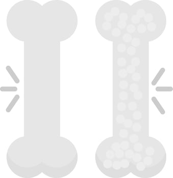 Osteoporosis Vector Icon Design