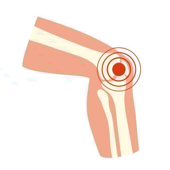 Arthritis joint pain concept vector illustration. Human knee pain.