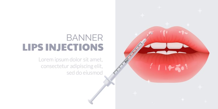 3D illustration of realistic beige lips undergoing cosmetic correction. Procedure of lip filler injections, correction for a plump and youthful appearance. For cosmetic, dermatology, plastic surgery vector