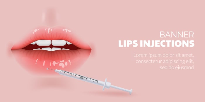 3D illustration of realistic lips undergoing a cosmetic procedure for aging care. Results of lip injections and wrinkle reduction, the correction and contouring of lips using fillers injection. vector