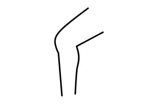 knee line drawing isolated on white background. Vector illustration.
