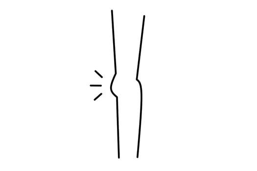 knee line drawing isolated on white background. Vector illustration.
