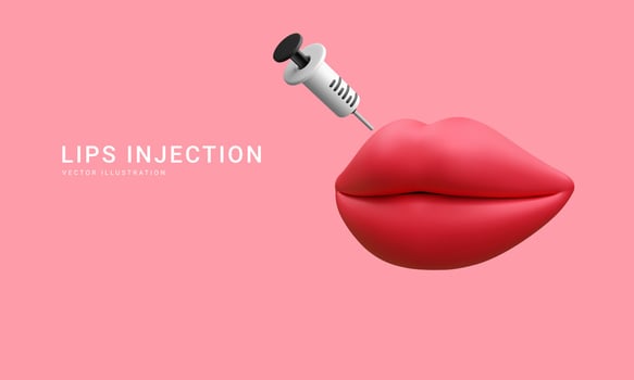 3d realistic banner for lip augmentation procedure. Lips injection of hyaluronic acid. Beauty clinic concept. Vector illustration