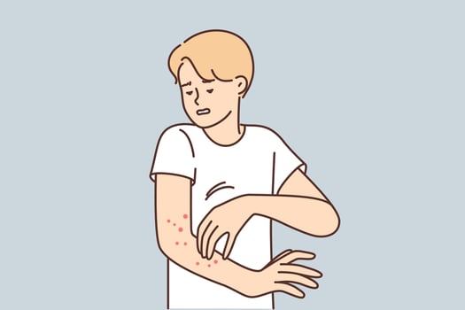Man with rash on arm suffers from itching and eczema caused by infection that affects skin. Guy needs medicated ointment or dermatologist help to get rid of eczema spreading all over body vector
