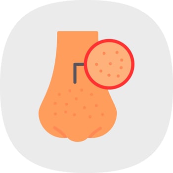 Blackhead Vector Icon Design
