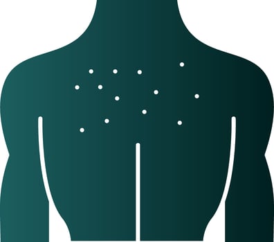 Burn  Vector Icon Design