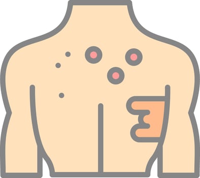 Burn  Vector Icon Design
