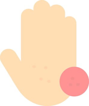 Skin Cancer  Vector Icon Design