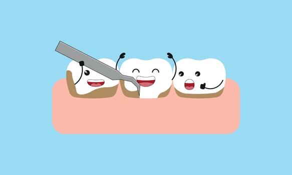 Cleaning tooth by removing tartar from the teeth illustration cartoon character vector design on blue background. Dental care concept.