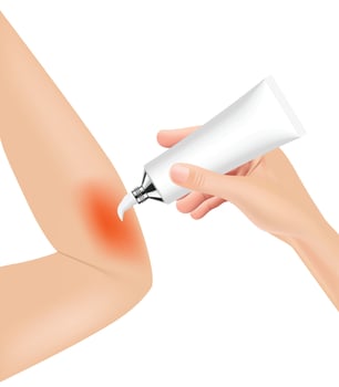 Skin burn injury treatment. First aid for burn wound vector illustration, elbow with skin injury. vector illustration. EPS10.