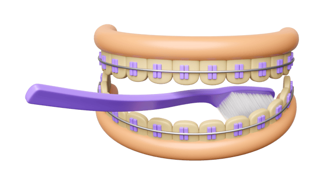 3d orthodontics cartoon, teeth braces with gum, clean toothbrush isolated. 3d render illustration png