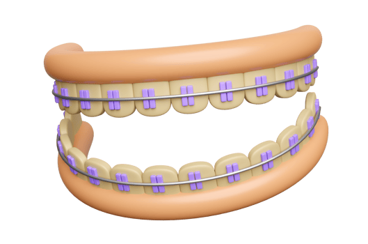 3d orthodontics cartoon, teeth braces with gum isolated. 3d render illustration png