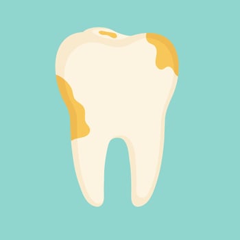 Tooth with a plaque vector illustration