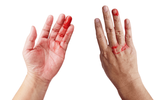 Bloody male hand isolated PNG transparent