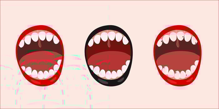 set of open mouths with broken and healthy teeth, vector flat illustration