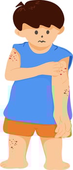 A cartoon boy drawing having itching and redness, children's allergy skin, allergy symptoms, dermatitis vector illustration.