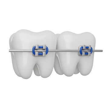 Teeth braces 3D render icon png