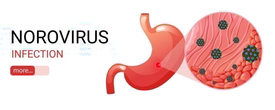 Stomach and norovirus infection under magnification banner vector